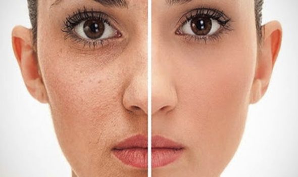 imagen de Rejuvenecimiento con Láser C02 clinica renacimiento madrid y marbella estetica facial