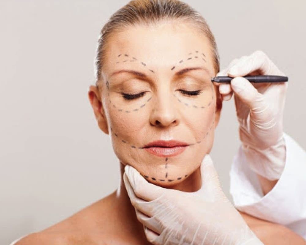 imagen de lifting facial cirugia estetica facial clinica renacimiento