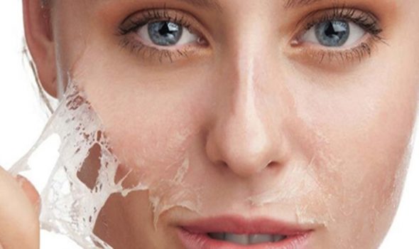 imagen de peeling clinica renacimiento madrid y marbella estetica facial